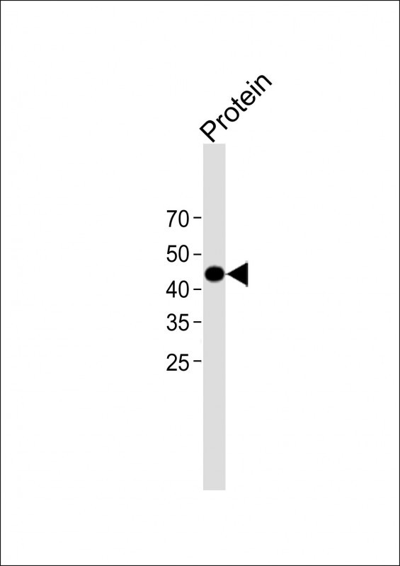1 - GST Antibody AM1011b